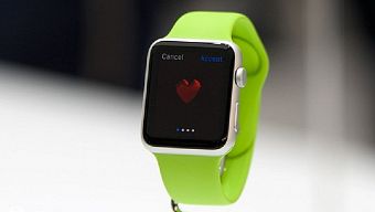 ios, iphone, smartphone, apple watch, apple watch 2