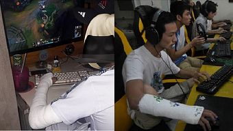 liên minh huyền thoại, top game hot 2018, gãy tay chơi game, gãy tay vẫn quẩy game, game thủ gãy tay, gãy tay vẫn chiến game