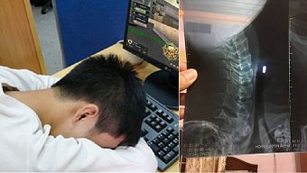top game hot 2018, chơi game nhiều giờ liên tục, chơi game lâu, chơi game nhiều giờ, chơi game sai tư thế, hậu quả của chơi game nhiều, thoái hóa xương vì chơi game, mắc bệnh do chơi game, hậu quả của chơi game lâu