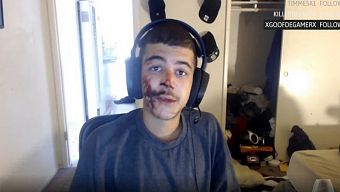 twitch, livestream, streamer, twitch khóa tài khoản, cộng đồng streamer, streamer twitch, livestream trực tuyến